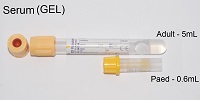 Serum - Gel tube - Contains Clot Activator