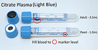 Citrate Whole Blood