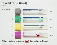 QFT Plus Tubes